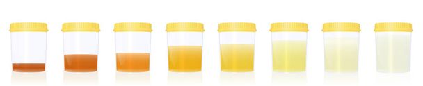 Urine colors, gradations from clear to yellow and orange and even darker, samples in specimen cups with different colored urine -. Indicator of the level of dehydration. Vector on white. - Vector, Image