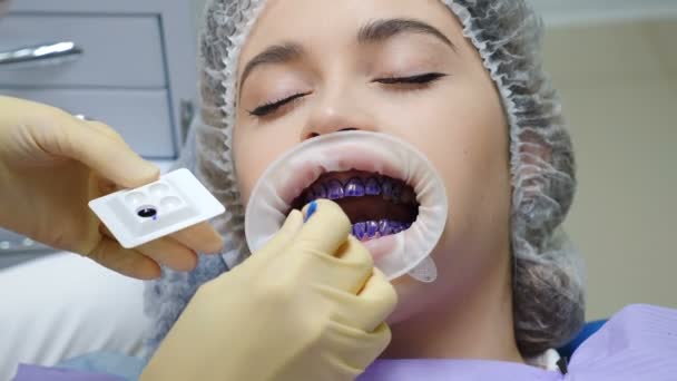 Prática odontológica. Procedimento de higiene dentária. Escala de dentes profissional. Paciente feminina em cadeira dentária em consultório odontológico moderno. limpeza dos dentes, higiene oral e limpeza profilática. 4 k vídeo - Filmagem, Vídeo