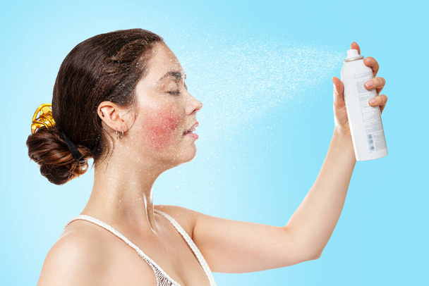 A young Caucasian woman with rosacea on her cheeks splashes thermal water on her face and smiles with relief. Side view. Blue background. Concept of cosmetology, skin care and rosacea/ - Photo, Image