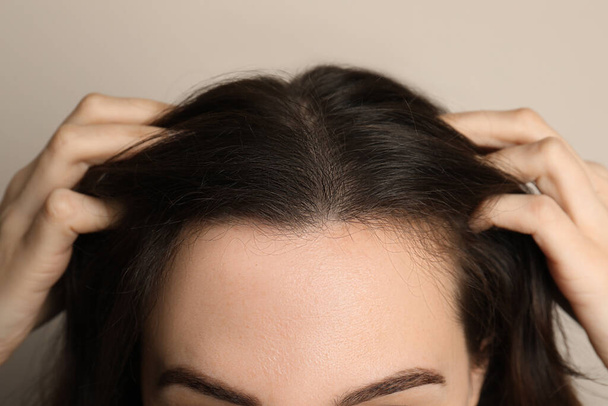 Woman suffering from baldness on grey background, closeup - Zdjęcie, obraz