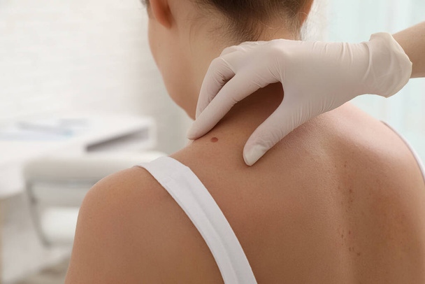 Dermatologist examining patient's birthmark in clinic, closeup - Photo, Image