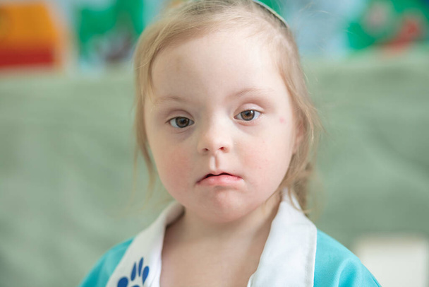 Síndrome de Down en una niña, un niño discapacitado, una enfermedad psiquiátrica genética, un cromosoma extra en humanos - Foto, Imagen
