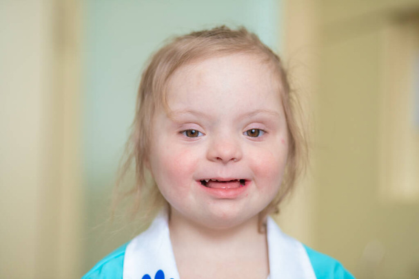 Down syndrome in a little girl, disabled child, a genetic psychiatric disease, an extra chromosome in humans - Foto, afbeelding