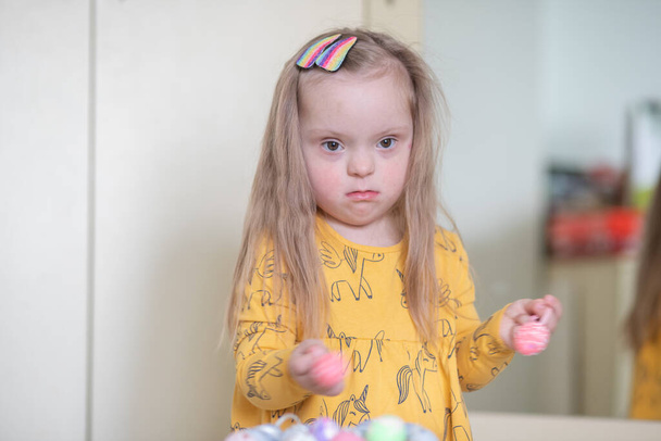 gyönyörű lány Down-szindróma játszik húsvéti tojás. - Fotó, kép