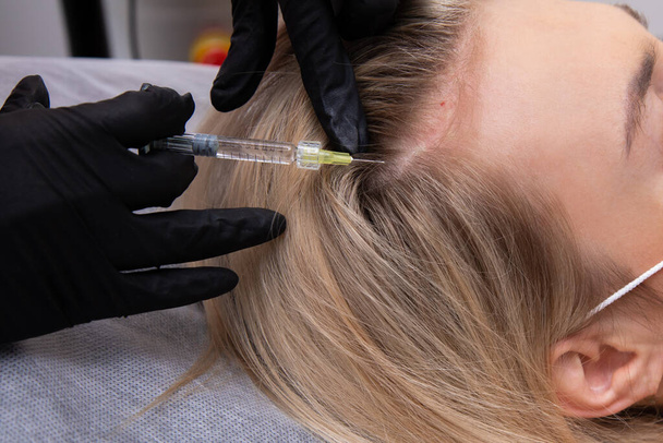 Uma mulher loira com cabelo tingido sofre de perda de cabelo e recebe injeções de mesoterapia na cabeça. Conceito de restauração capilar - Foto, Imagem