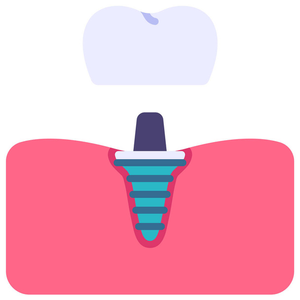 ikona implantu gumy dentystycznej w stylu Flat - Wektor, obraz
