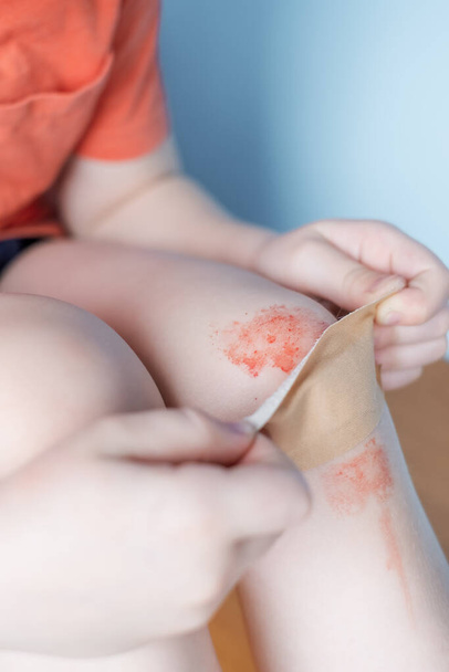 Dítě nanáší náplast na zraněné koleno - Fotografie, Obrázek