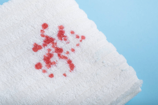 macchia di sangue su un asciugamano bianco. macchia sporca di vita quotidiana per il lavaggio e il concetto pulito - Foto, immagini