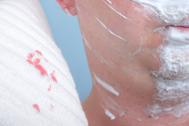 sangue dopo la rasatura su un asciugamano bianco - Foto, immagini