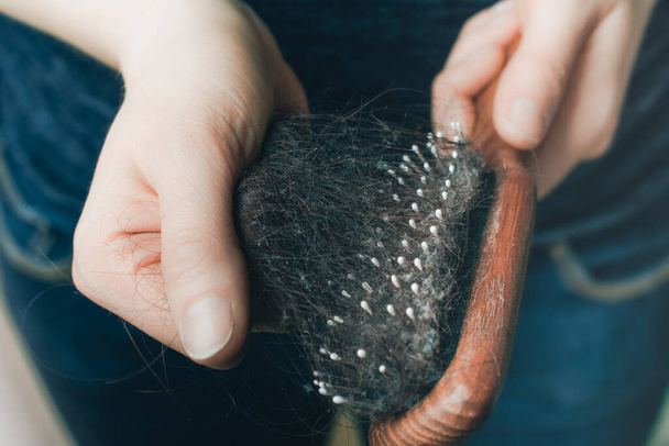 Frauen ziehen Bündel von Haaren aus der Bürste - Alopecia Haarausfall-Konzept - Foto, Bild