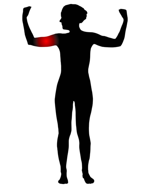 上腕の痛みを持つ女性の正面図 - ベクター画像