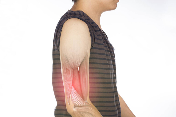 Armmuskelverletzung weißer Hintergrund Armschmerzen - Foto, Bild