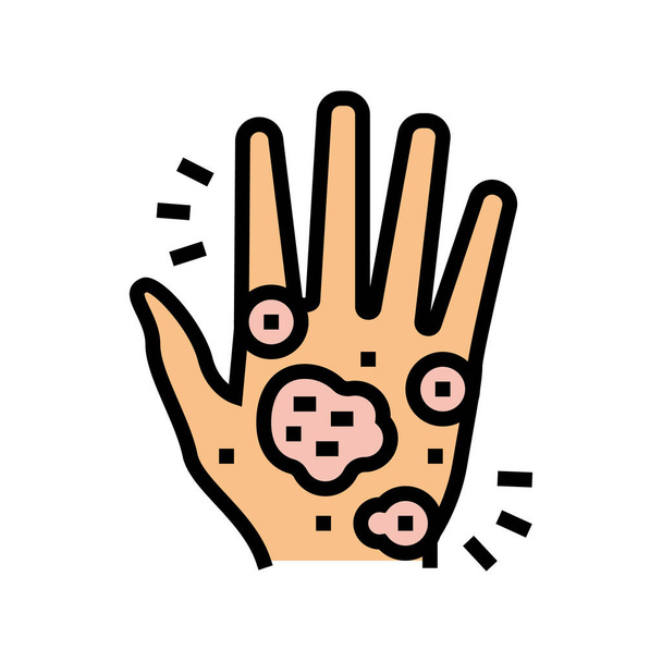 mão eczema cor ícone vetor ilustração - Vetor, Imagem