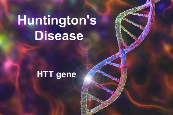 Enfermedad de Huntington, también conocida como corea de Huntington, una enfermedad neurodegenerativa debido a una mutación en el gen de la huntingtina, HTT, ilustración conceptual 3D - Foto, Imagen