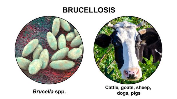 Brucellose. Illustration 3D de bactéries Brucella et photo d'une vache. Les bactéries Brucella sont transmises à l'homme par les bovins et autres animaux par contact direct avec des animaux malades ou par le lait contaminé. - Photo, image