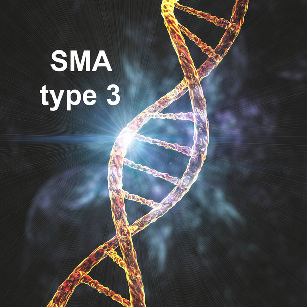 Atrofia muscular espinal, SMA, tipo 3, un trastorno neuromuscular genético con desgaste muscular progresivo debido a la pérdida de neuronas motoras debido a la mutación en el gen SMN1, ilustración conceptual 3D - Foto, Imagen