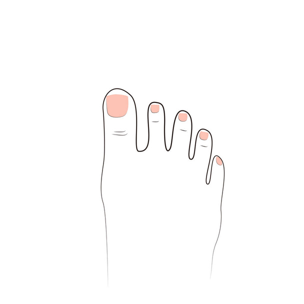 Un piede con le dita dei piedi e una pedicure. Vista dall'alto. Isolare su uno sfondo bianco - Vettoriali, immagini