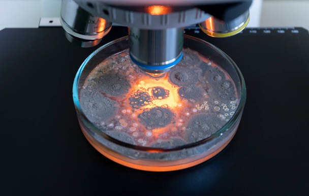 Bacteriën in een petrischaaltje onder de vergroting van de microscoopdoelstellingen. De petrischaal is rood gemarkeerd. De bacteriën gloeien met een rood-geel licht onder een microscoop. - Foto, afbeelding