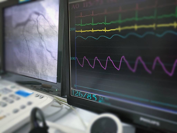 No laboratório de cateterismo, havia múltiplos monitores que apresentavam sinal vital e resultado coronariano do paciente. Foco no centro da imagem, outras partes são borradas. - Foto, Imagem