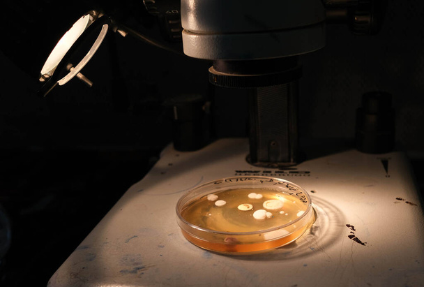 basra, Irak - április 30, 2021: fotó a gombák növekedését agar média Petri-csészében - Fotó, kép