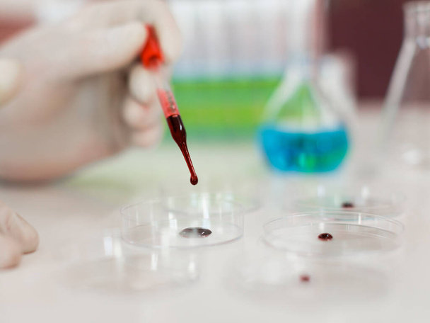 Onderzoekers geven een laboratorium een bloedmonster in een petrischaal. Focus op de druppelaar. - Foto, afbeelding