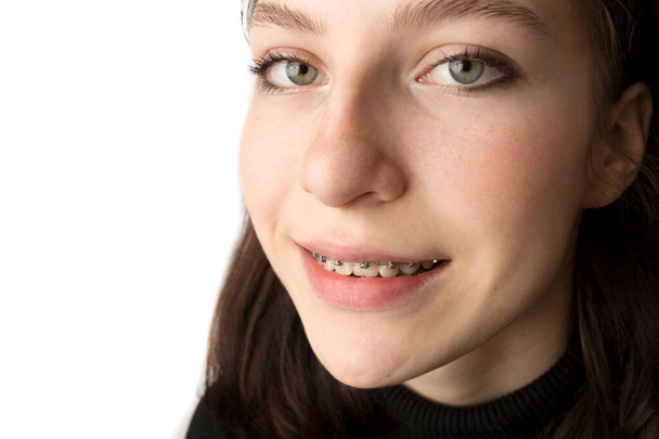 Traitement orthodontique. Concept de soins dentaires. Adolescente souriante avec bretelles. Braces métalliques gros plan sur les dents. - Photo, image