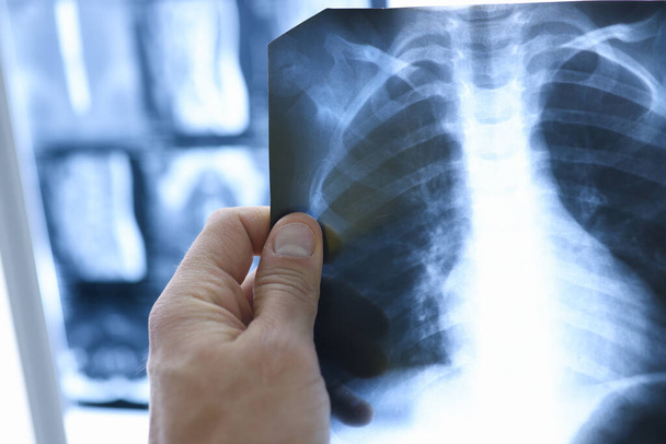 Los médicos sostienen rayos X de los pulmones en el consultorio médico. - Foto, imagen