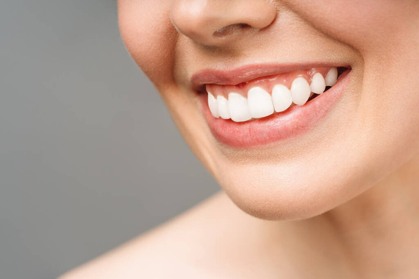 若い女性の完璧な健康的な歯の笑顔.歯が白くなる。歯科医院の患者だ。画像は口腔ケア歯科、胃学を象徴しています - 写真・画像