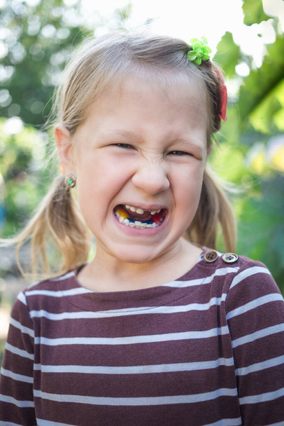 Niño con un dispositivo de ortodoncia dental y sin un diente. - Foto, Imagen