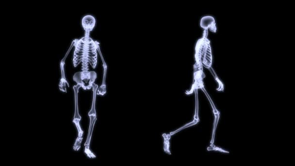 x-ray ακτινογραφία του ανθρώπινου σώματος (σκελετός) - Πλάνα, βίντεο