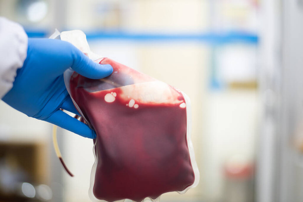Закрыть пакет крови в лаборатории банка крови. - Фото, изображение