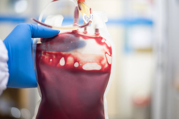 Крупним планом Кров'яна сумка в лабораторії банку крові
. - Фото, зображення