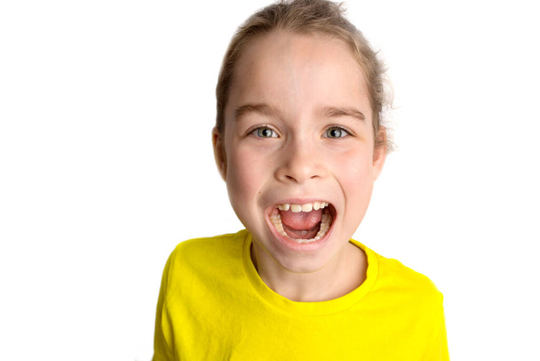 Petite fille se tient sur un fond blanc avec un beau sourire, les enfants dents tordues, dentisterie pédiatrique. Dents tordues en gros plan. La correction de la malocclusion est nécessaire. - Photo, image