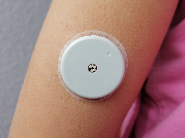 Kan CGM 'inde sürekli glikoz izleme cihazı için elinizdeki sensörü kapatın. Diyabet Tipi 1 - Fotoğraf, Görsel
