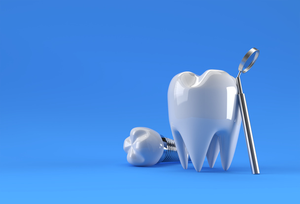 Концепція хірургії стоматологічних імплантатів 3D Rendering
. - Фото, зображення