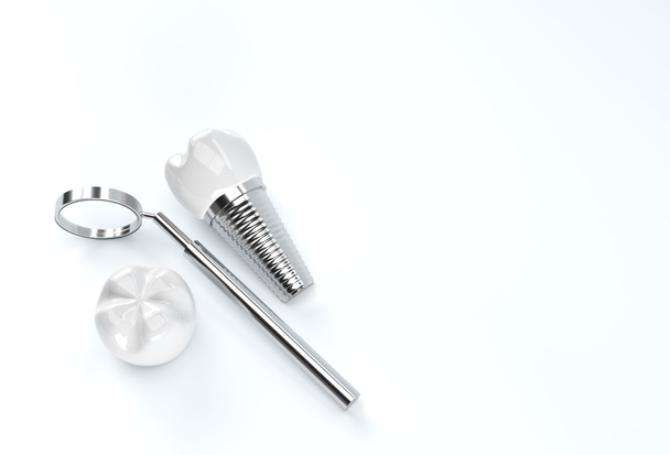 Οδοντικά εμφυτεύματα χειρουργική έννοια 3D Αποτύπωση. - Φωτογραφία, εικόνα
