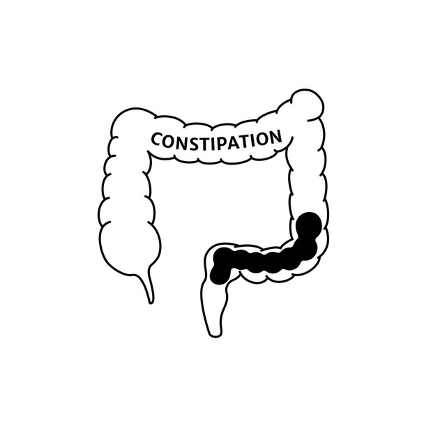 線状の黒い便秘サイン。医学的概念大腸直腸の問題。解剖学、アプリの医療、サイト、情報グラフィックポスターの要素です。白い背景に孤立した物体は - ベクター画像