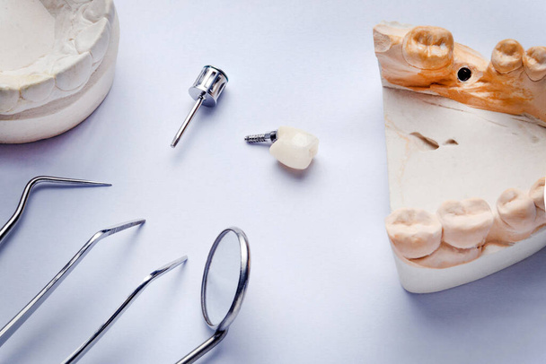 couronne d'implant dentaire sur fond blanc avec modèles en plâtre et instruments dentaires, sonde, miroir et pince à épiler - Photo, image