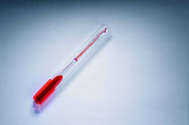 Medical laboratory. A test tube with blood on a white background. The concept of laboratory research. Close-up. - Photo, Image