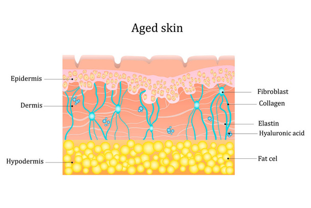 Starzejąca się warstwa skóry. Ludzka struktura skóry z włókien kolagenu i elastanu, kwasów hialuronowych, fibroblastów. Ilustracja schematyczna. Schemat wektora - Wektor, obraz