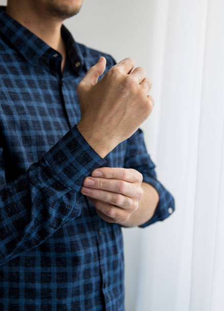 vitiligo man's hand fastens the sleeve of his shirt - 写真・画像