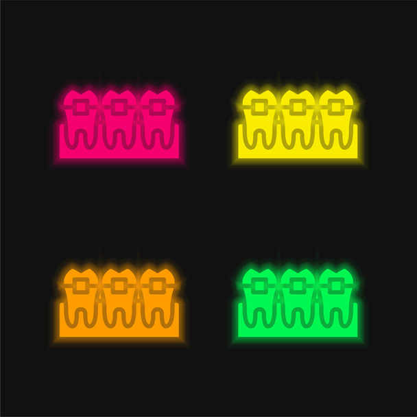 Braces quatre couleurs rougeoyantes icône vectorielle néon - Vecteur, image