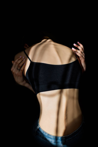 A girl with anorexia turned back, spine and ribs visible. Young woman with anorexia sitting alone and feeling unhappy. Anorexia problem concept. - Photo, Image