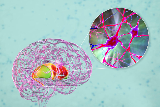 Dorsal striatum aivoissa ja lähikuva näkymä sen neuronien, 3D-kuva. Se on ydin tyven ganglia, koostuu caudate ydin (punainen) ja putamen (vihreä) - Valokuva, kuva