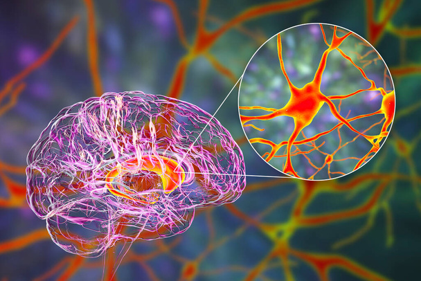 Ihmisen aivojen ja sen neuronien tumat, 3D-kuva. Caudate-ydin on osa perushermosoluja, sillä on rooli koreoissa, neurodegeneratiivisissa ja muissa aivosairauksissa. - Valokuva, kuva
