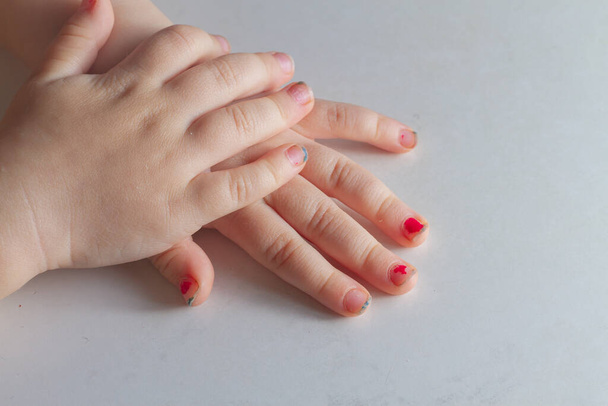 The hands of a baby girl with painted nails with peeling red varnish and dirty nails that need to be trimmed. - Фото, зображення