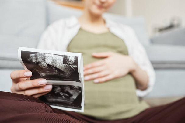 Nahaufnahme einer schwangeren Frau mit Ultraschall ihres Babys in den Händen - Foto, Bild