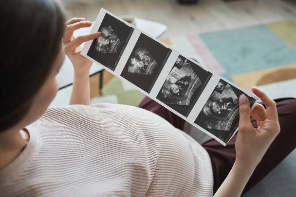 Schwangere sitzt auf Sofa mit Röntgenbildern, die sie im Ultraschall ihres Babys betrachtet - Foto, Bild