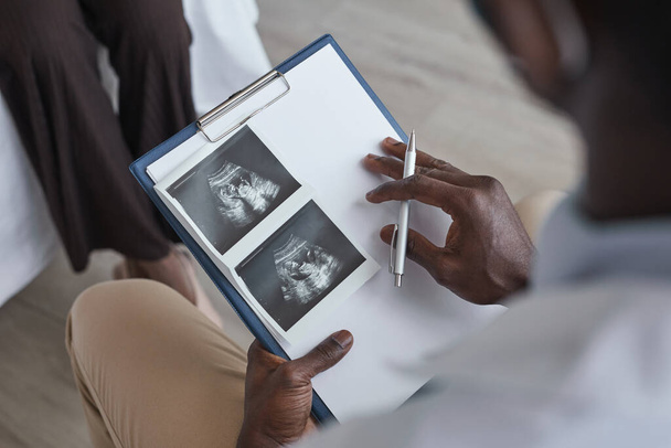 Close-up of African doctor holding clipboard and examining ultrasound image with patient visiting him at hospital - Foto, afbeelding