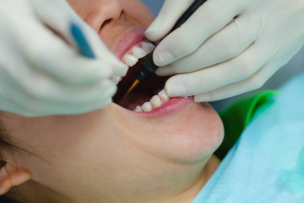 Привлекательная женщина проходит стоматологическое лечение и специалист в резиновых перчатках делает проверку и лечение зубов пациента. Концепция здоровья полости рта.  - Фото, изображение
